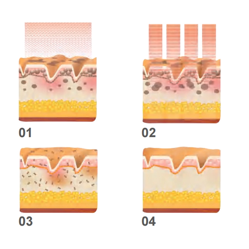 picosecond-machine.webp